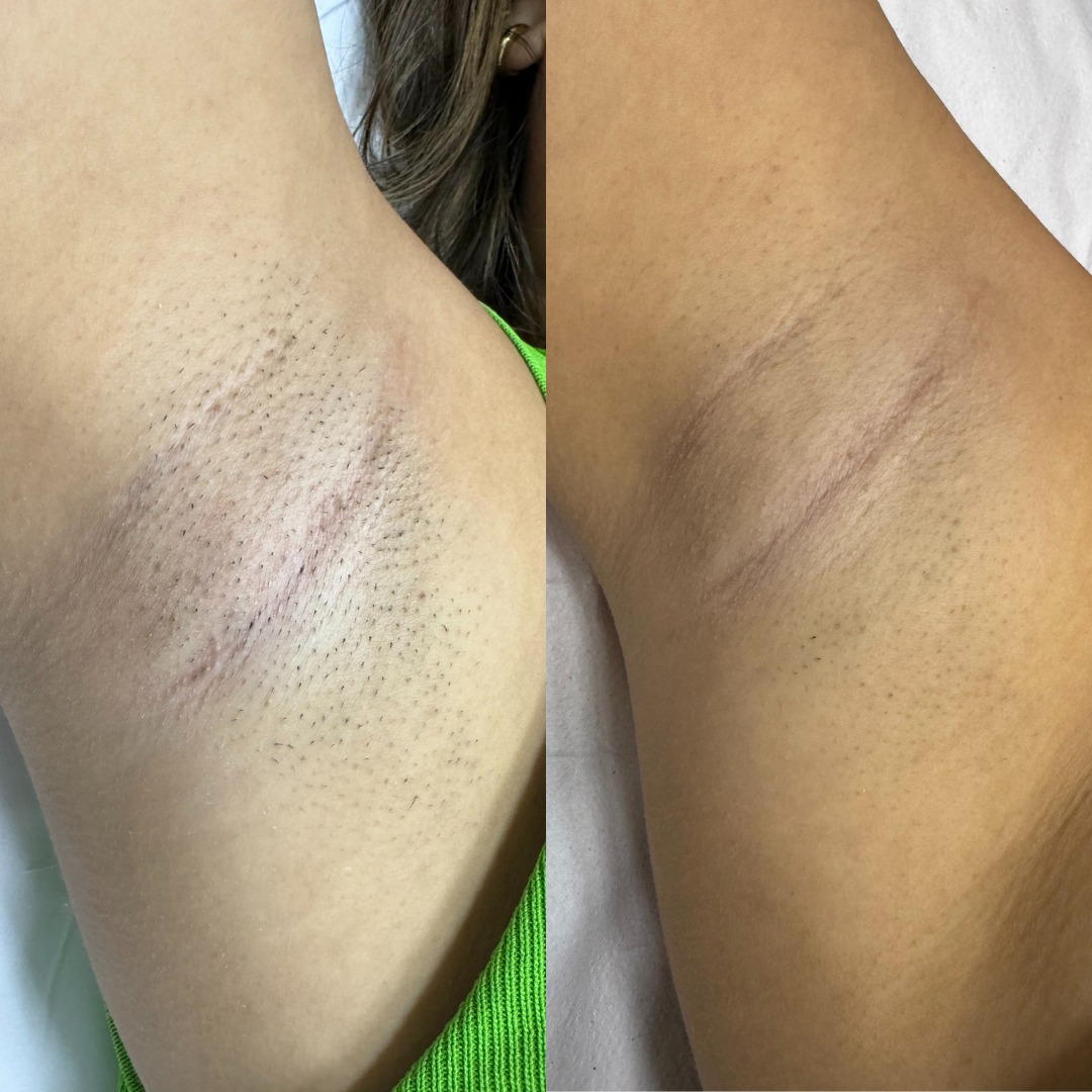 Antes e depois 10