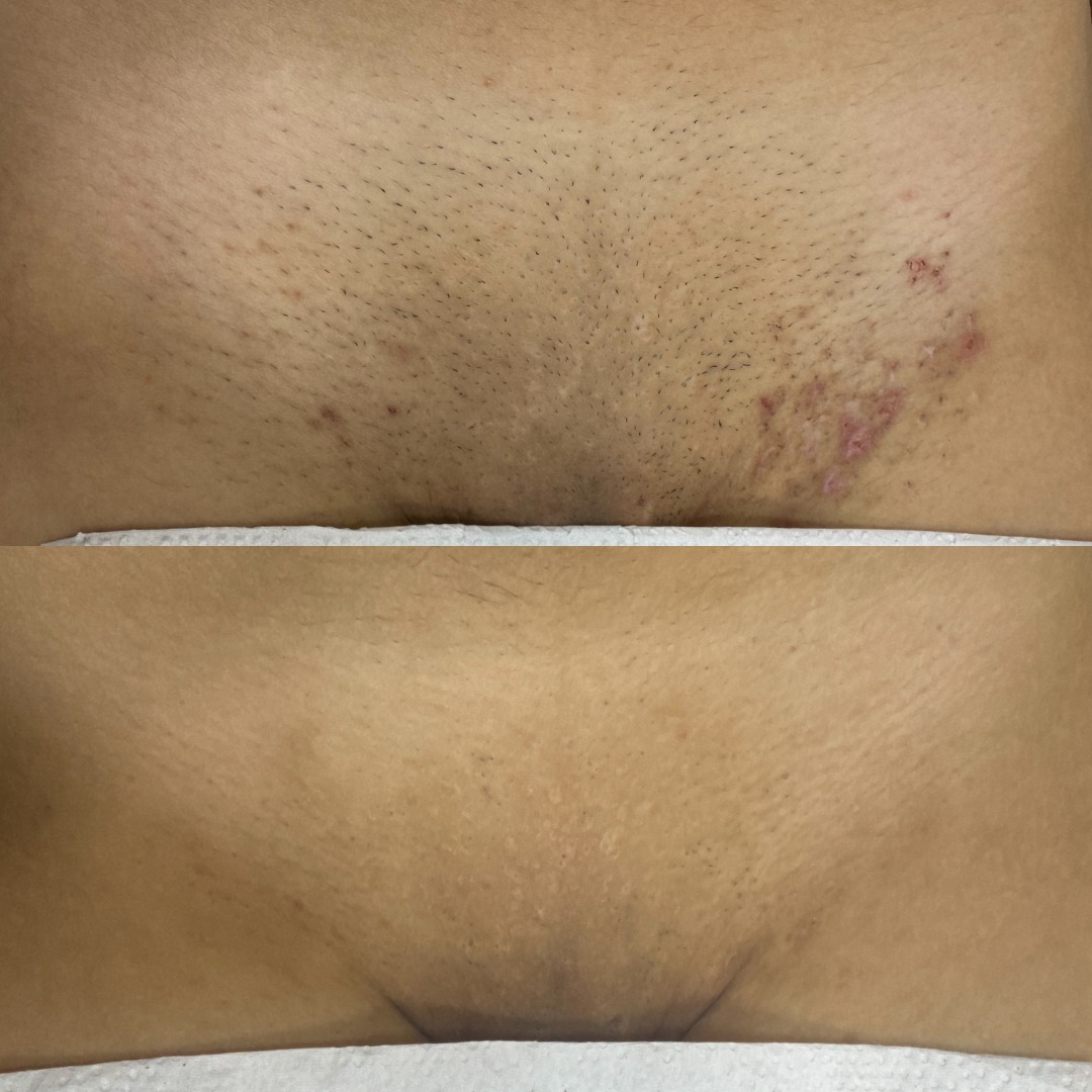 Antes e depois 6