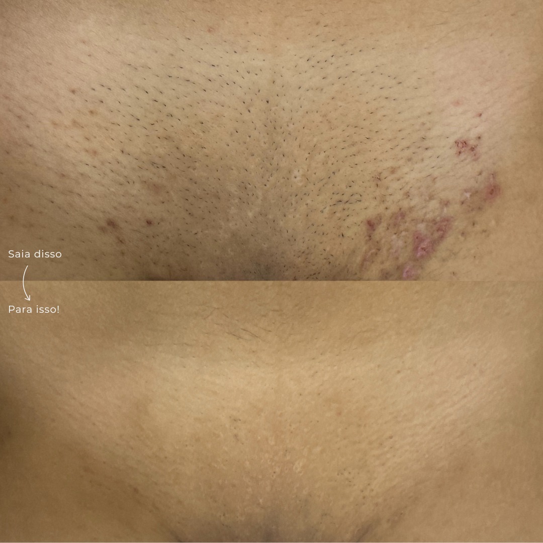 Antes e depois 8