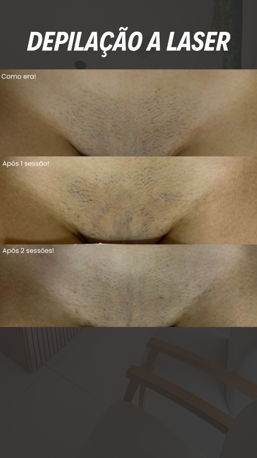 Antes e depois 9