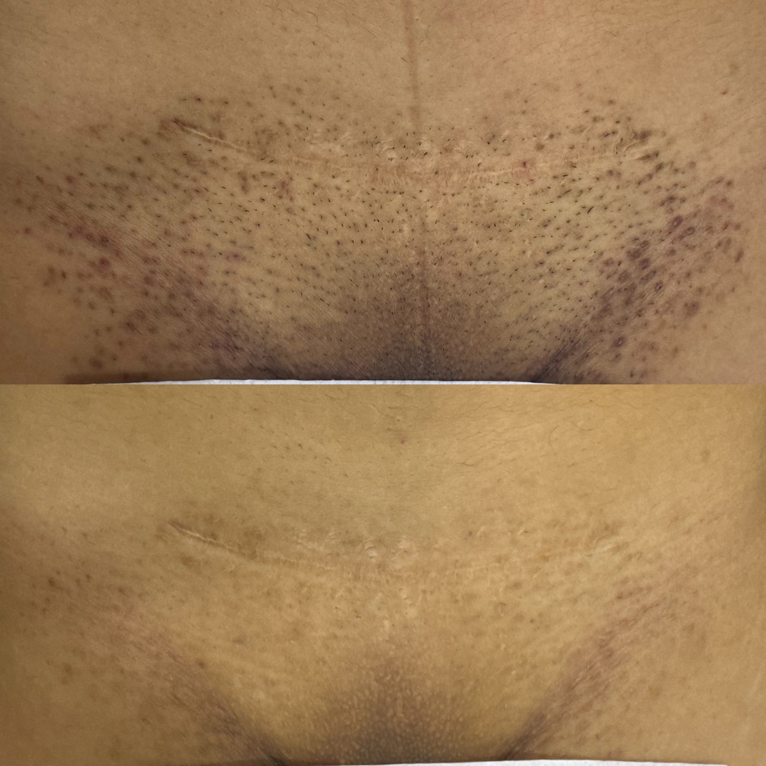 Antes e depois 5