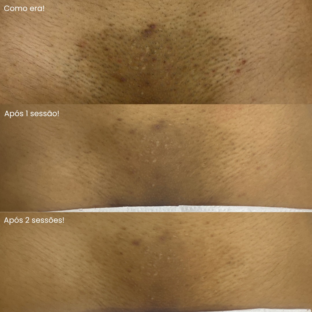 Antes e depois 3