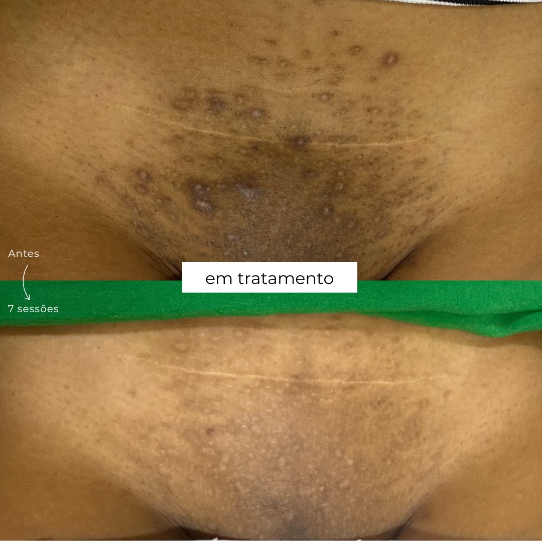 Antes e depois 4